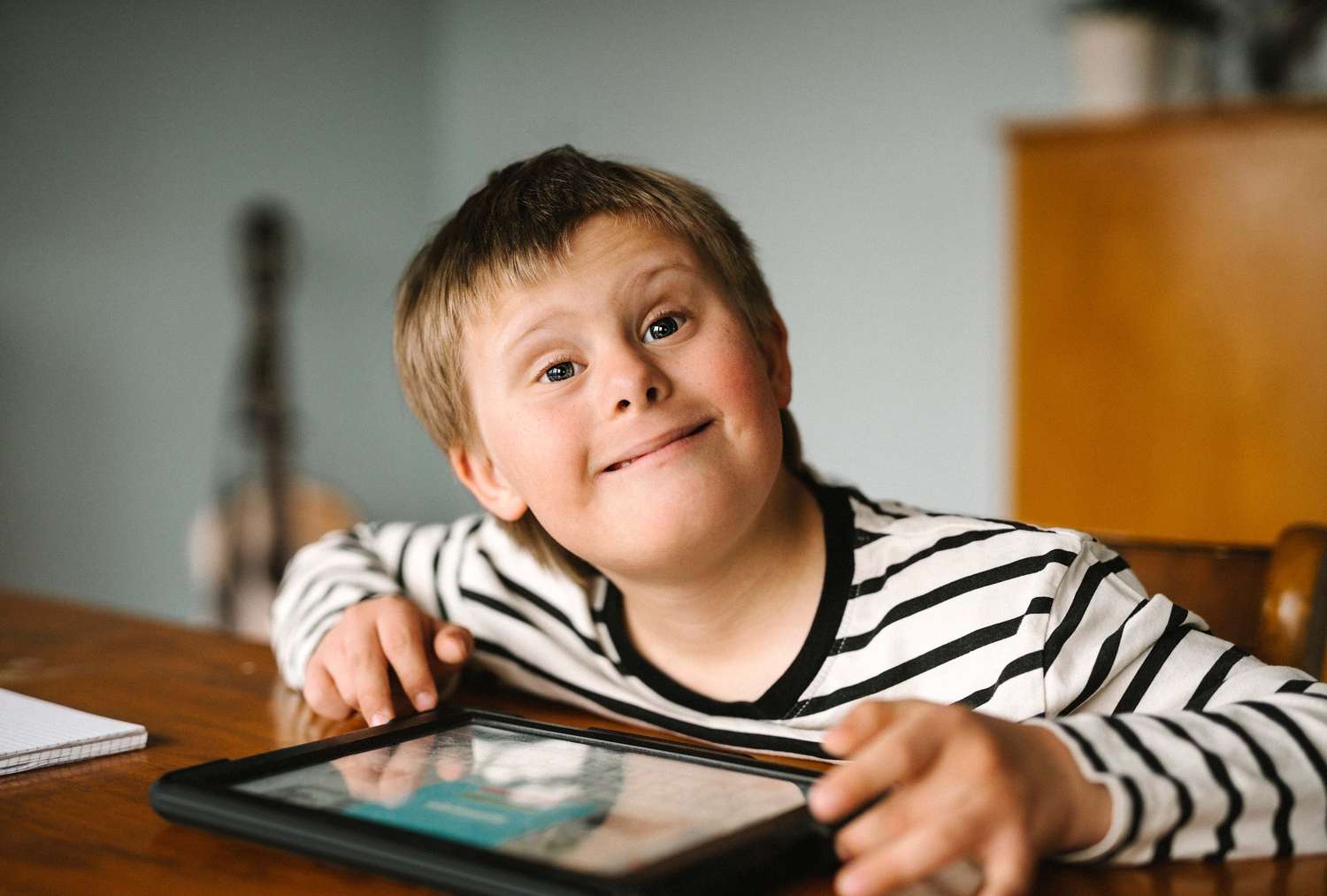 25 Fakta Om Downs Syndrom