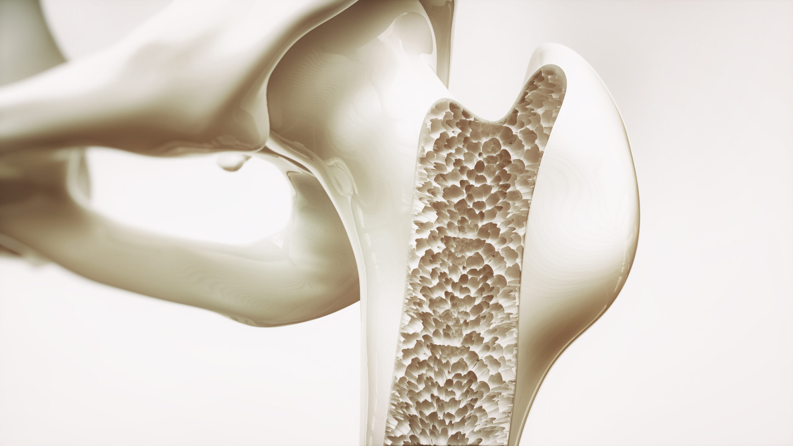 29 Fakta Om Osteoporos