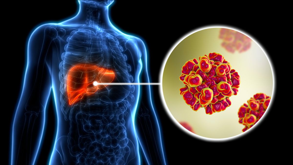 32 Fakta Om Hepatit